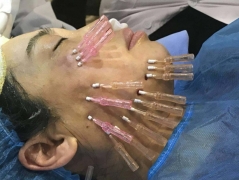 ҽƾֲݼʡ޺ߵѵ