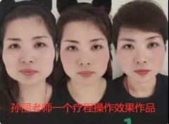 ͽ˽+沿 һ