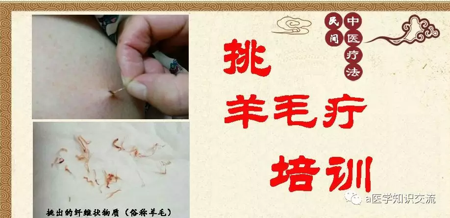 民间羊毛疔挑治