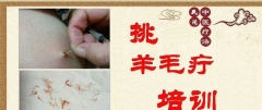 德州李红挑羊毛疔课程'学习培训